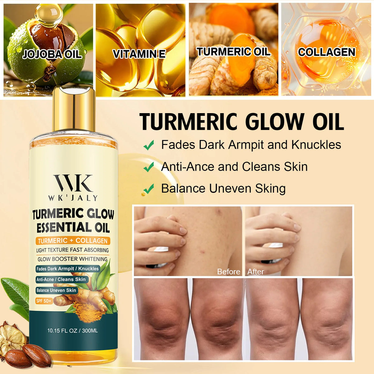 WK Jaly Moisturizing Skin Care Kit for Acne and Spots