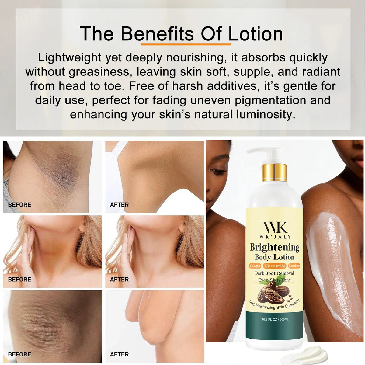 WK Jaly Moisturizing Skin Care Kit for Acne and Spots