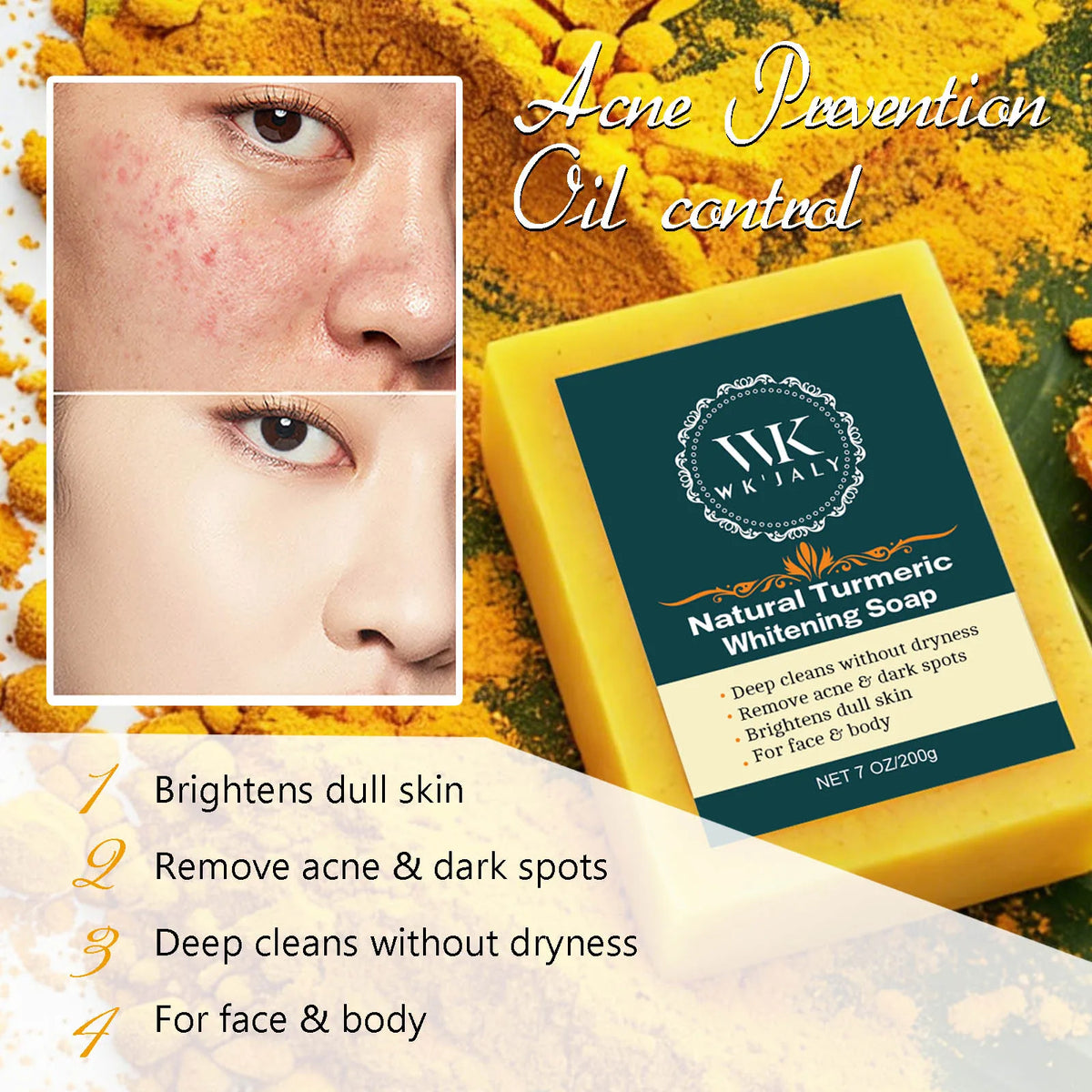 WK Jaly Moisturizing Skin Care Kit for Acne and Spots