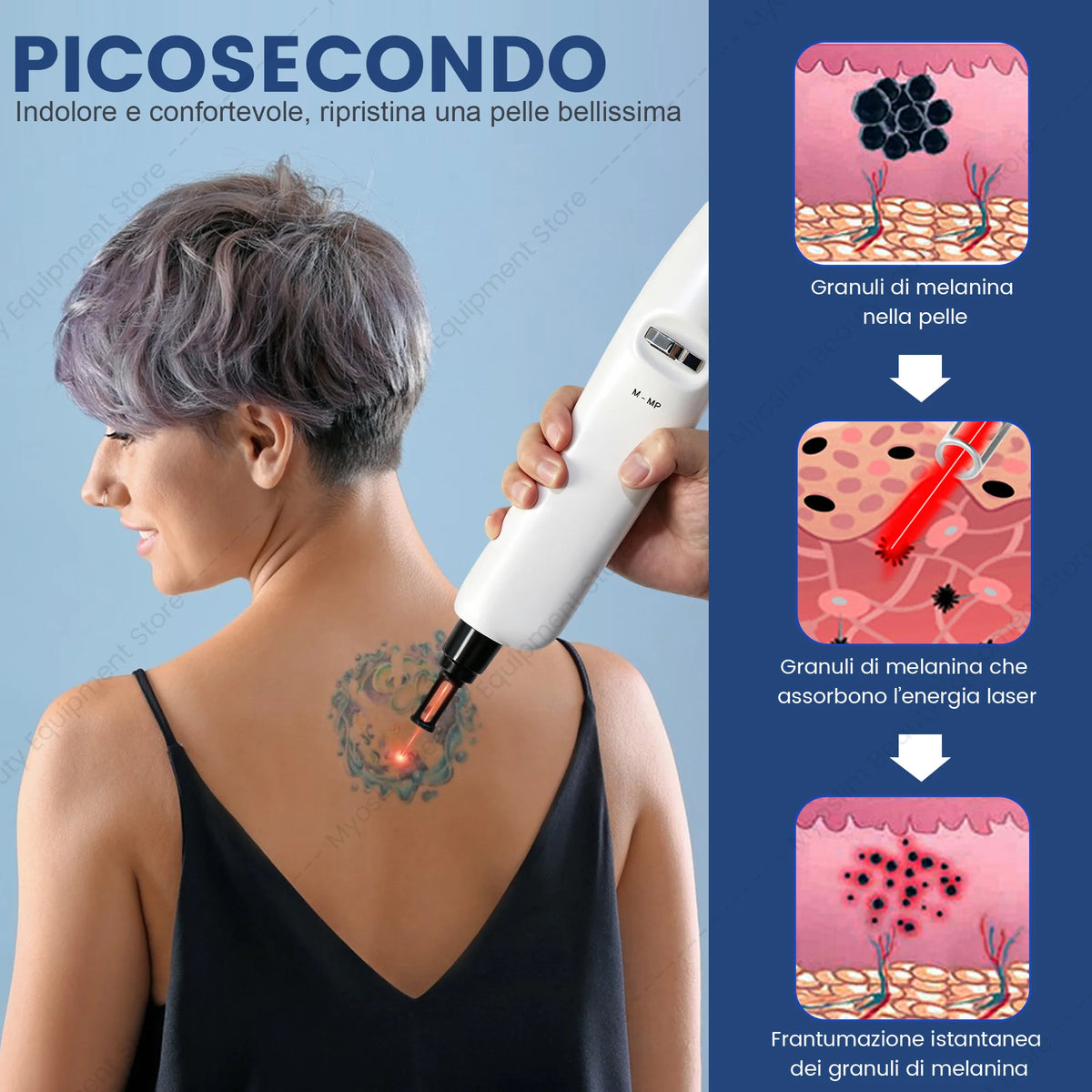 New High-Efficiency Portable Pico Lase Machine (532nm/755nm/1064nm) - Professional Beauty Device for Tattoo & Freckle Removal