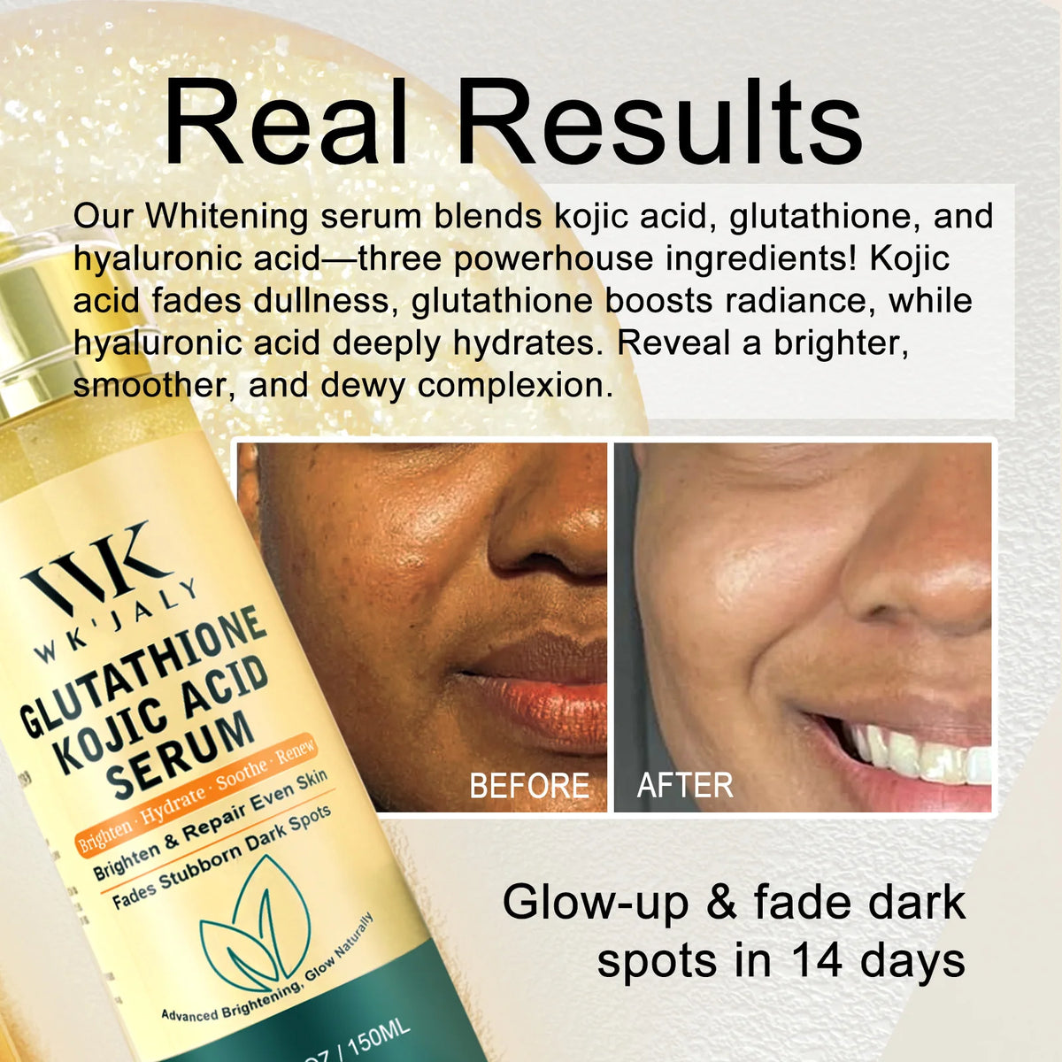 WK Jaly Moisturizing Skin Care Kit for Acne and Spots
