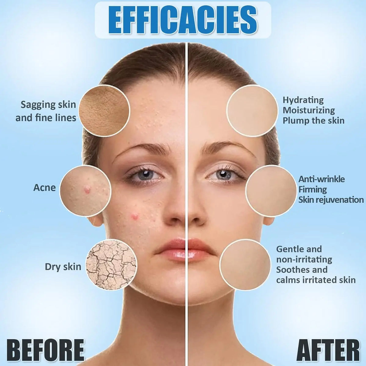 YMEYFAN Five In One Hyaluronic Acid Skincare Set For Hydration